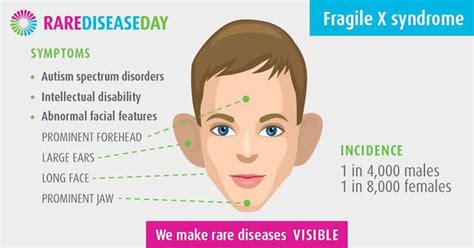 Symptoms Of Fragile X Syndrome MEDizzy