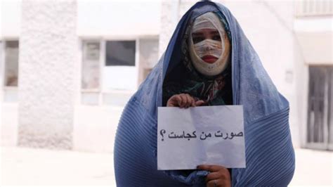 اسید پاشی به زنان و دختران در کابل؛ نظرات شما Bbc News فارسی