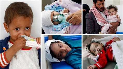 اليمن شبح المجاعة يخنق براءة الأطفال