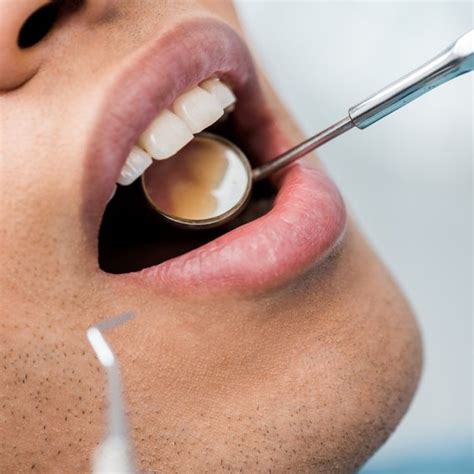 Oral And Dental Care Avoid Cavities And Tooth Decay The Healthy
