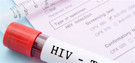 Übergewicht zu erkennen und zu bekämpfen, soll den menschen helfen, langfristig gesund zu bleiben und im endeffekt länger zu leben. HIV - Wann kann man von Heilung sprechen?