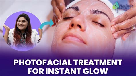 Photofacial Treatment Procedure Photofacial Treatment For Skin