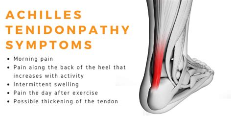 Achilles Tendinopathy Body And Mind Physiotherapy