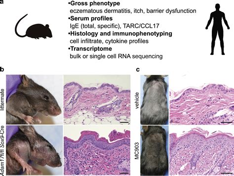 Research Techniques Made Simple Mouse Models Of Atopic Dermatitis