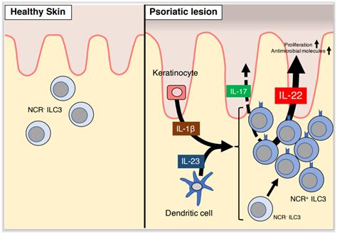 Ijms Free Full Text Role Of Innate Immune Cells In Psoriasis