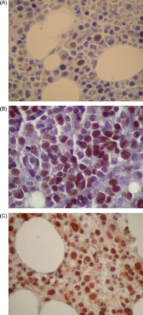 Figure 1 From Bone Marrow Cell Cycle Markers In Inherited Bone Marrow
