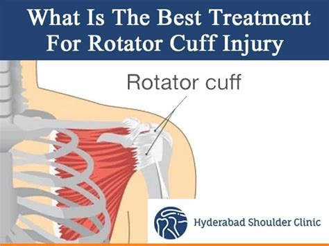 Rotator Cuff Physical Therapy In Hyderabad Shoulder Clinic Hyderabad