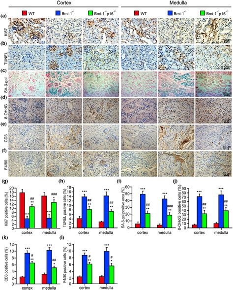P16 Deletion Improved Renal Aging And Associated Inflammatory Cell