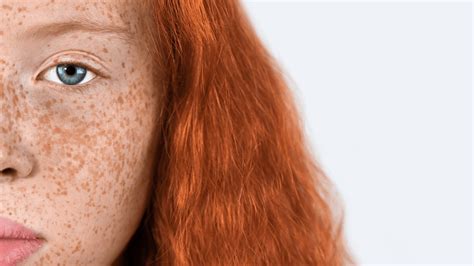 New Study Redheads Feel Less Pain And The Reason Why Is Fascinating