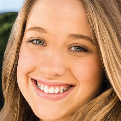 Carriere® Motion Appliance Orthodontic Treatment In Hertfordshire Bishops Stortford Orthodontics