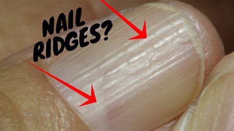 What do the vertical lines on nails suggest? Do You Have These Vertical Ridges On Your Nails?-Palmistry ...