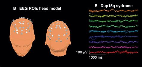 Putting Electronics Of Brain Waves To Use Must Read
