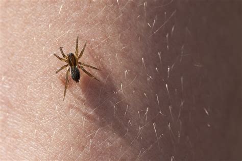 How To Recognize And Treat Spider Bites Patient Advice Us News