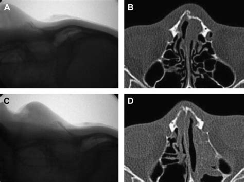 References in A new approach to the treatment of nasal ...