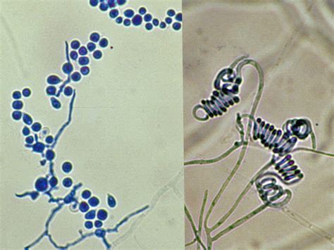 Trichophyton Mycology University Of Adelaide