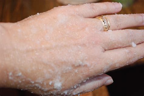 Home Recipe For Dry Chapped Hands You Probably Have Everything You