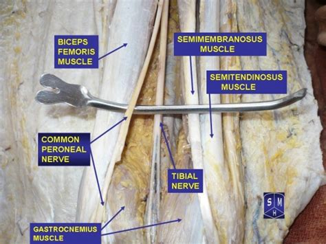 Common Peroneal Nerve Path