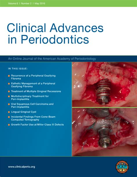 PDF Cover Page Of Clinical Advances In Periodontics