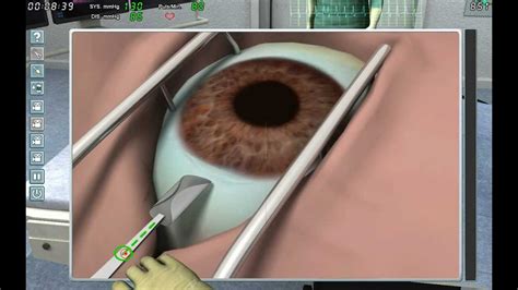 Chirurgie Simulator 2011 Katarakt [hd] Youtube