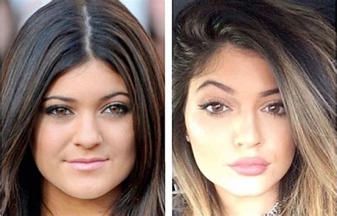 The biggest change in the youngest jenner sibling has been her pout. Kylie Jenner's plastic surgery. The width of her jaw has ...