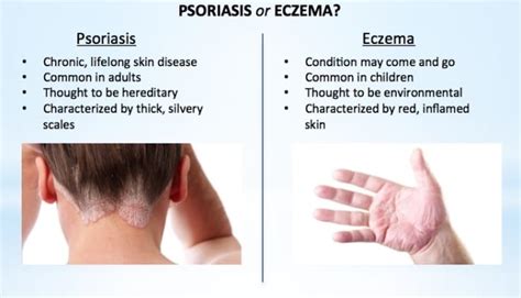 How To Tell If You Have Eczema Or Psoriasis And How To Get Rid Of Both