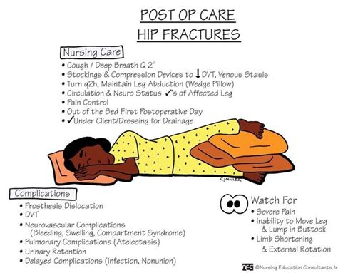 Traction is a set of mechanisms for straightening broken bones or relieving pressure on the spine and skeletal system. buck's traction nursing care - Google Search | school | Pinterest | Google search, Google and Nclex