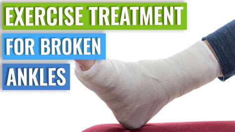 Ankle Fracture Treatment Recovery Time And Exercises Youtube