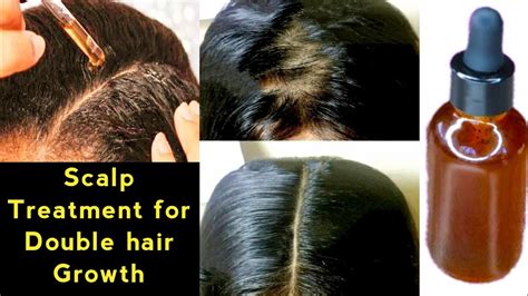 How To Grow Hair Very Fast In A Weekscalp Treatment For Hair Growth At