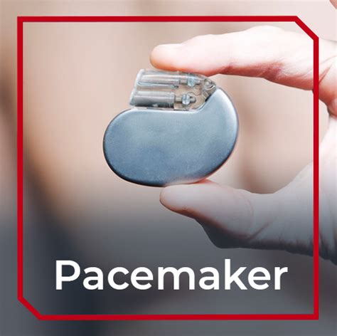 What Is A Pacemaker And What Is A Crt Pacemaker