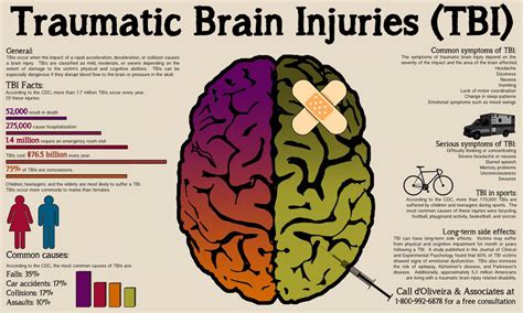 Understanding Concussion