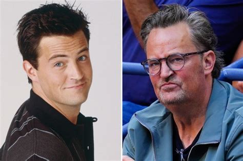 Matthew Perry Revealed He Lost All Of His Top Teeth In Harrowing