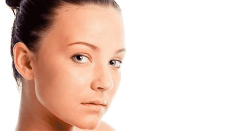 Skin Needling For Skin Redness Collins Cosmetic Clinic