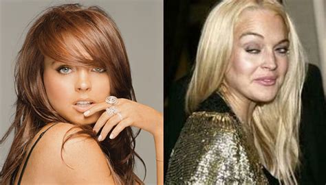 Top 10 Celebrities Who Look Worse After Plastic Surgery Youtube