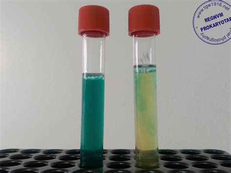 Regnum Prokaryotae Biochemical Tests