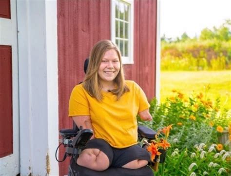 Untitled Wheelchair Women Amputee Quad