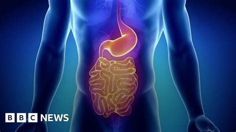 What Is Coeliac Disease And What Are The Symptoms Bbc News