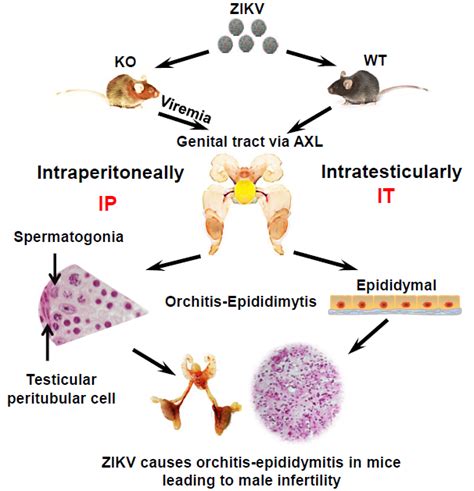 Zika Virus Infections Can Lead To Male Infertility In Mice A