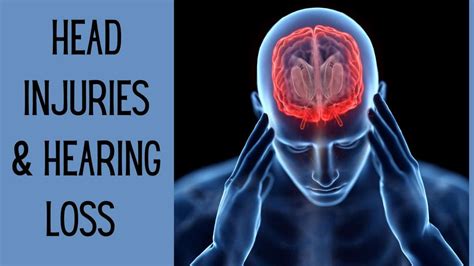 Head Injuries Hearing Loss Audiology Concepts