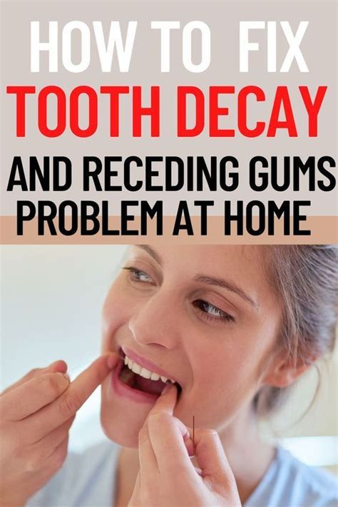 How To Get Rid Of Cavities Home Remedies And Prevention Fix Teeth Receding Gums Cure Tooth