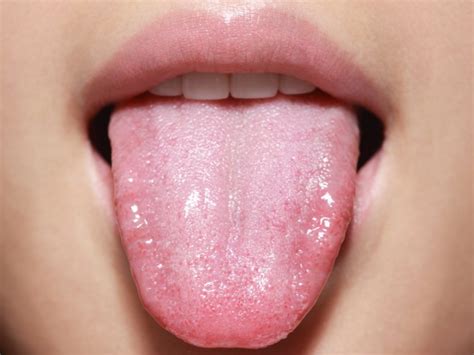 What Your Tongue Can Tell You About Your Health Chatelaine