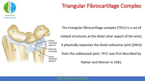 Triangular Fibrocartilage Complex Orthofixar 2023