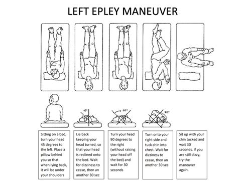 Epley Maneuver Pdf 3 Ways To Perform The Epley Maneuver