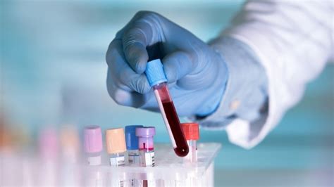Artificial Blood A Rare Discovery In Medical Science Researchers Who