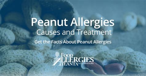 Get The Facts About Peanut Allergies Infographic Included Food