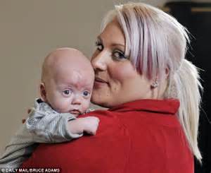 Mothers Horror After Discovering Dummy Taped To Her Four Month Old
