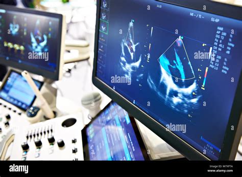 Medical Devices For Ultrasound Examination Stock Photo Alamy