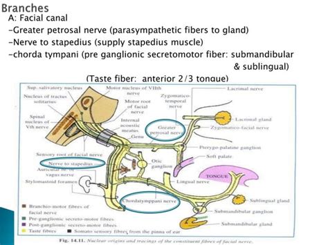 Multiple Cranial Nerve Palsy Final Ppt