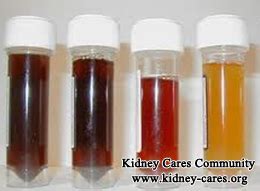 Certain foods such as blackberries, rhubarb, and beets, as well as. What Does Blood in Urine after Dialysis Mean_Kidney Cares ...