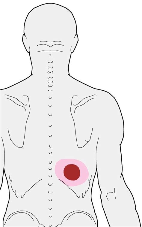 Pin on Muscle pain