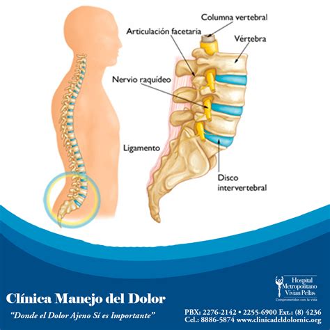 DOLOR DE ESPALDA EN LA PARTE BAJA Clínica del Dolor Dr Javier Bravo Villalobos